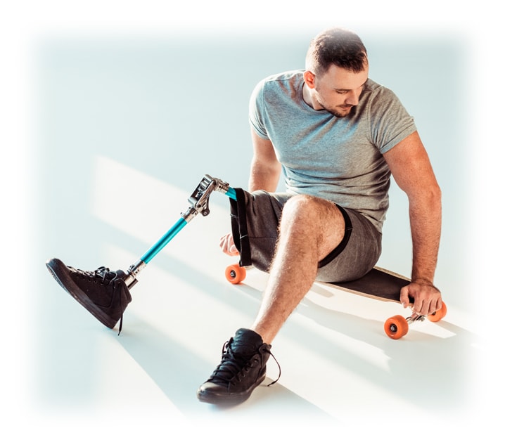 Patient with prosthetic leg demonstrating active mobility